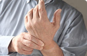 artrito formų sąnarių 16 m gydymas ir sąnarių osteochondrozė
