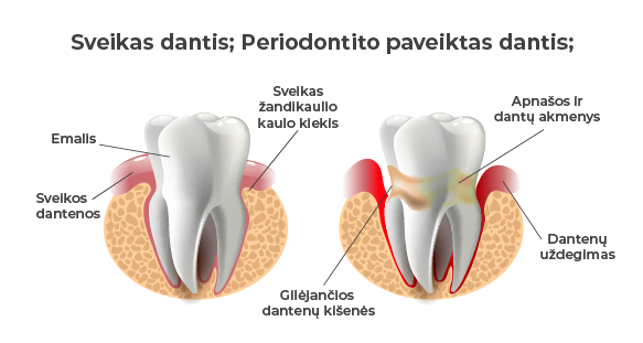 sąnarių ir dantenas žandikaulio sąnarių skausmas po odontologą