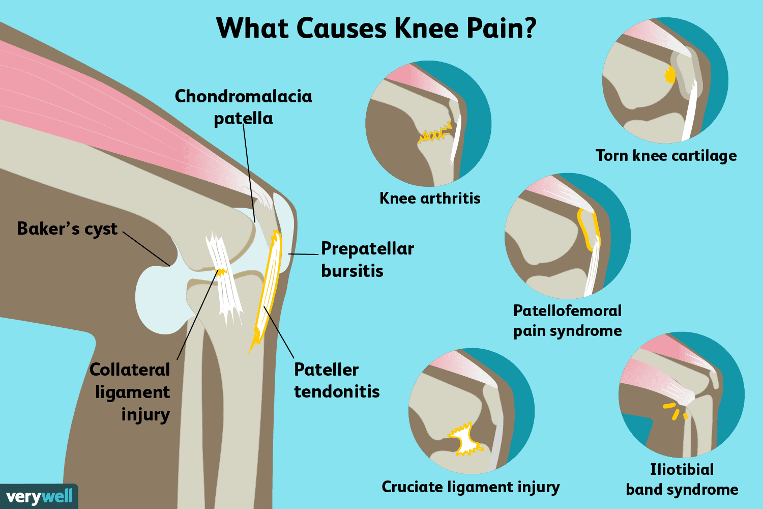 swelling in knee joints