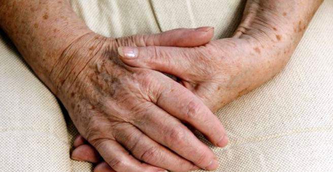 artritas dėl podagros rankas pašalinti skausmas alkūnės sąnario artrozė