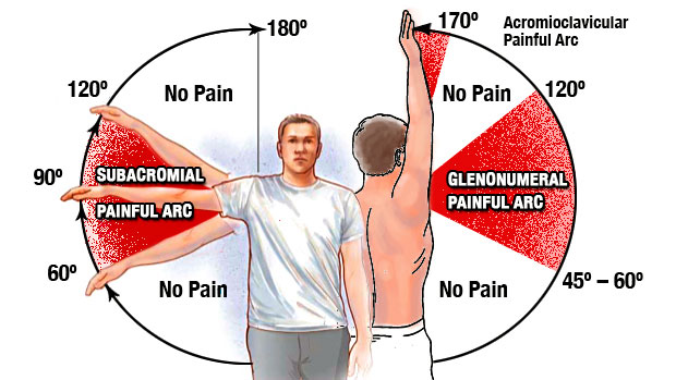 susirūpinęs skausmas rankose sąnarių priemonės su chondroitino ir gliukozamino