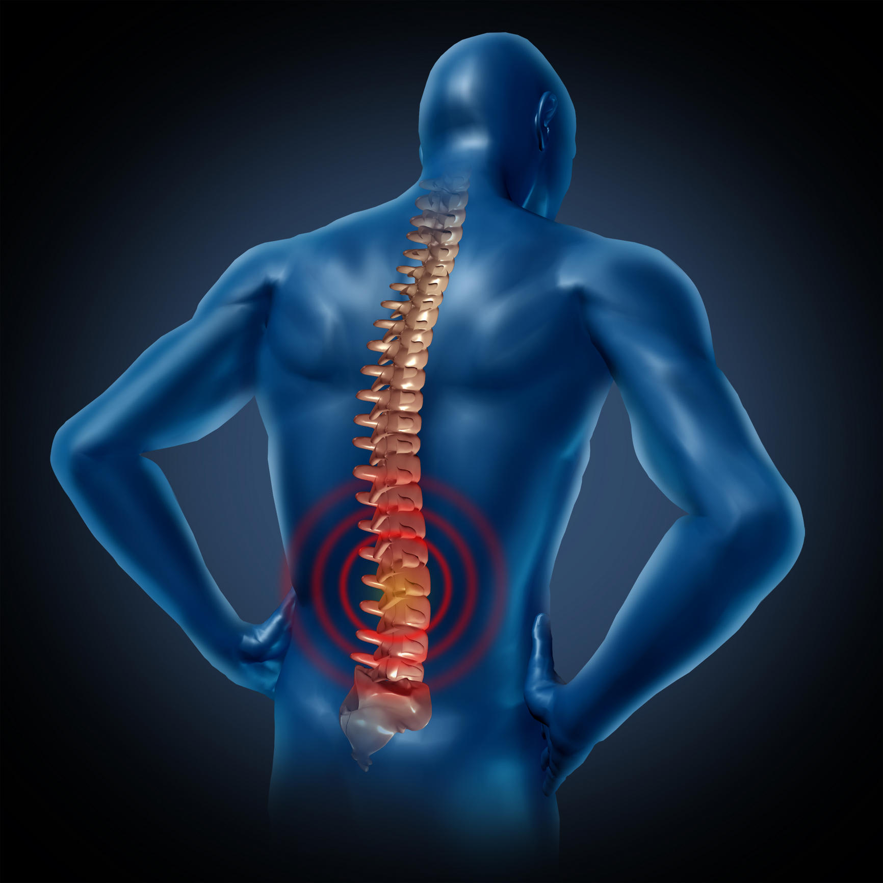 skausmo gydymo nugaros skausmas ir raumenų