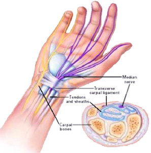 gerklės riešo sąnario rankų gydymui