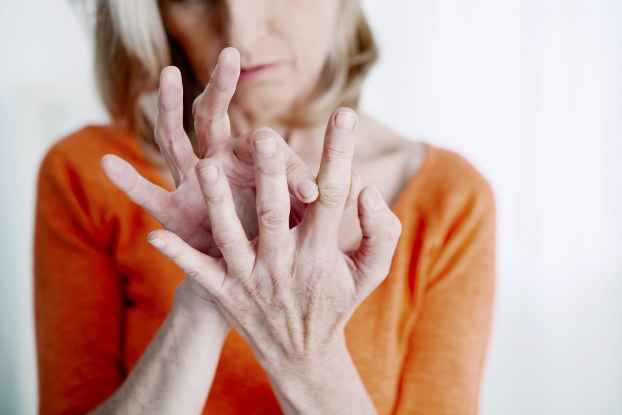 sukelia artritas rankų skausmas peties sąnario po miego