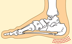 skausmas pėdos tradicinių gydymo sąnarių