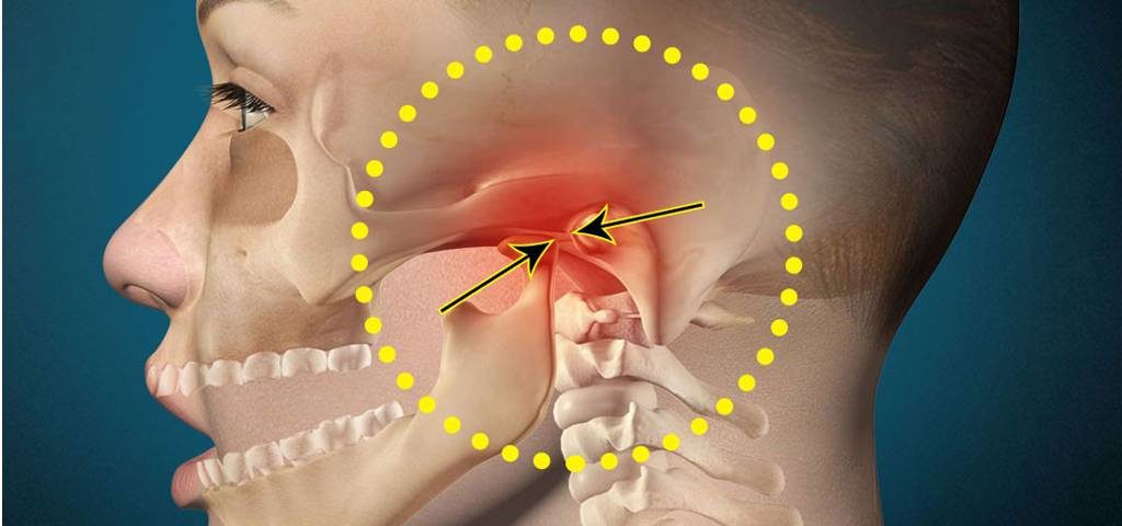 skausmas žandikaulio sąnario kai atidarymo skausmas pečių sąnarių kaip pašalinti skausmą