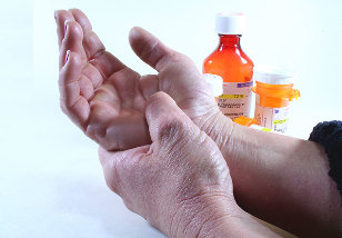 artritas su artrozės gydymas