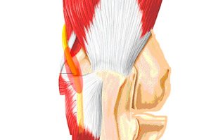 gydymas nuo alkūnės sąnario neuropatija sweep bendrą koją