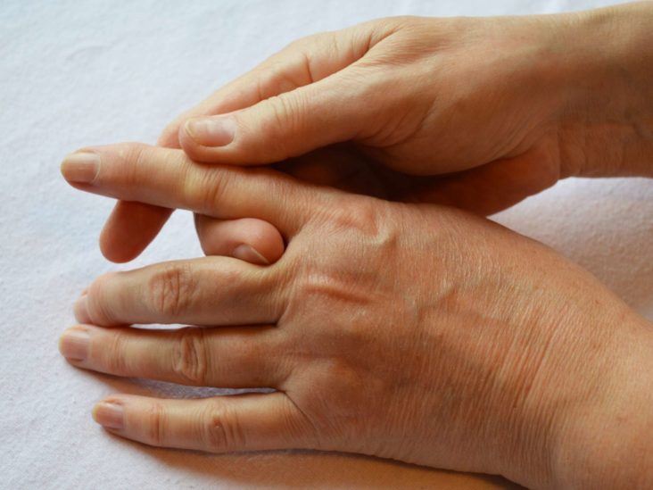 kaip gydyti reumatoidinį artritą japonijoje