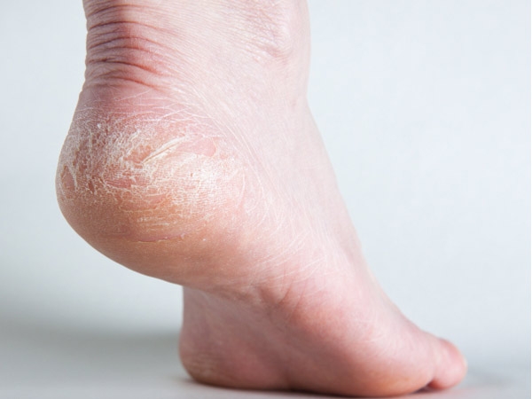 pėdų piršto gydymas
