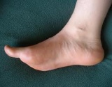 pulsuojanti pėdų skausmas