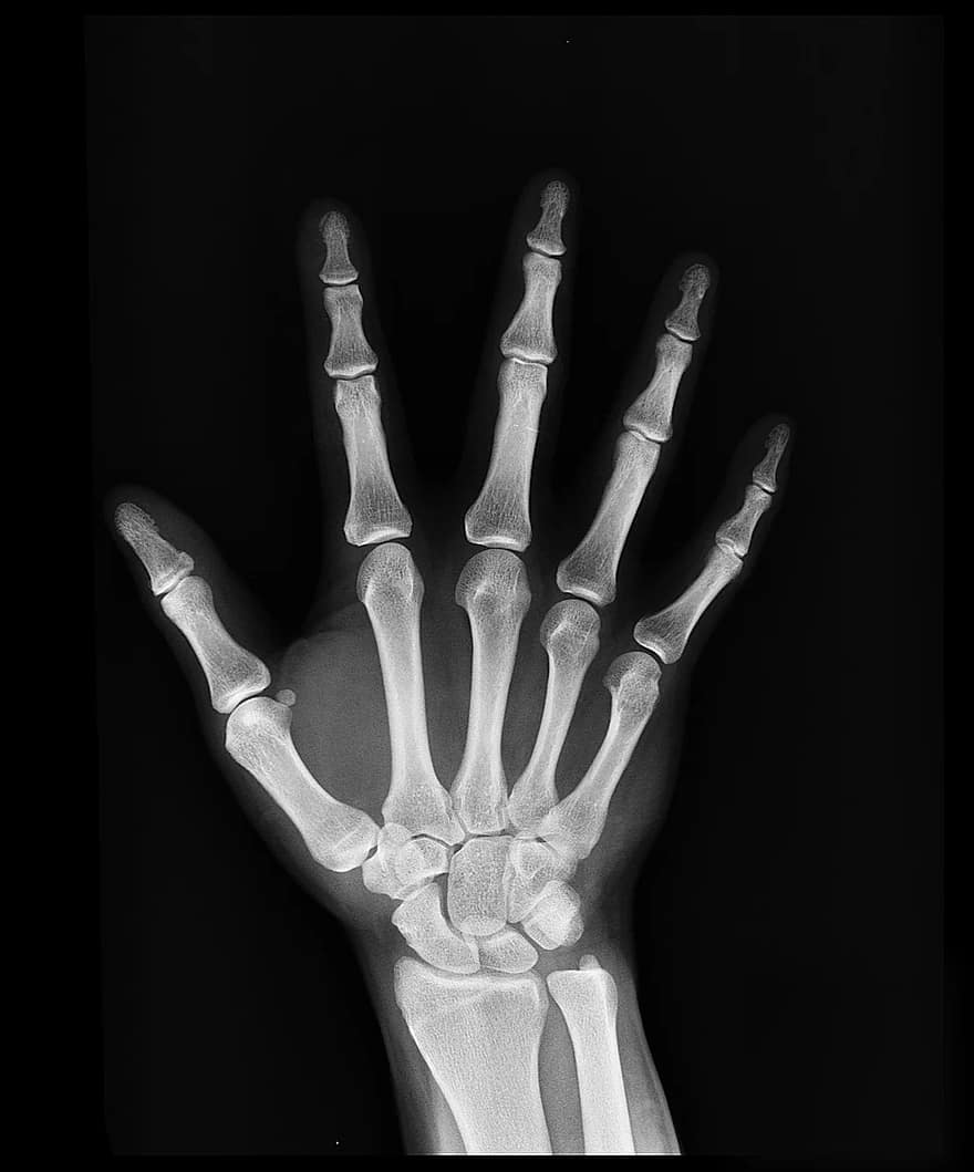 medicina artritas rankos šlaunies raumenys