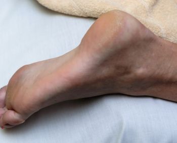 skauda kojos pirsta ligos nuo homeopatijos sąnarių
