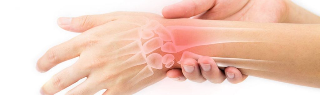 nurofen artritas sustava