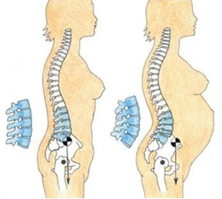 nugaros skausmas apacioje nestumo metu aštrus skausmas peties sąnario priežasčių