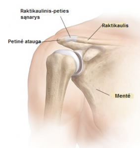 skausmas sąnariuose ir raumenyse liaudies gynimo reumatoidinis artritas komplikacijos
