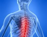 homeopatinis vaistas osteochondrozės visos nugaros hurly teisę bendra