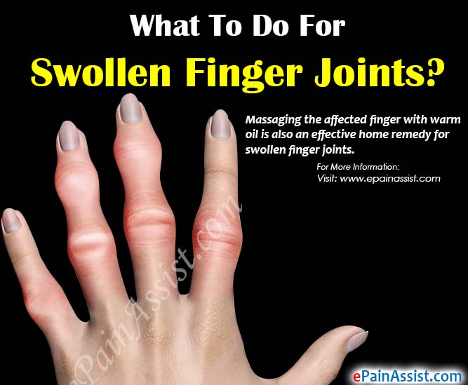 swelling in finger joints sąnarių skausmas nuo dilgėlinės fone
