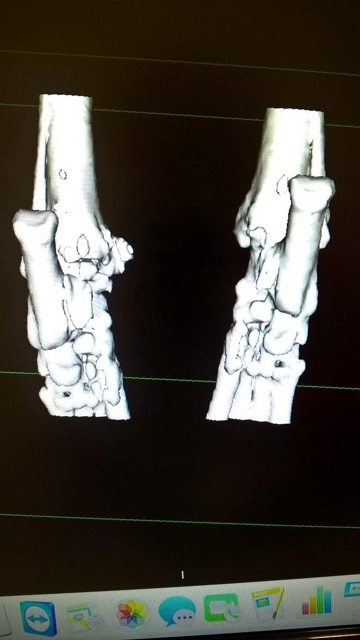 skauda alkūnės sąnario artrozės metu gerklės sąnarių ant kairės rankos piršto
