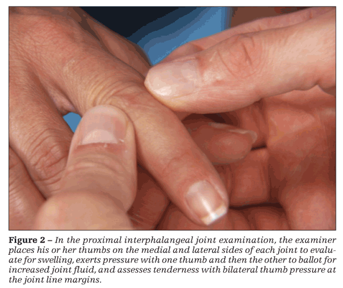 swelling in joints on one side of body alkūnių gydymo tepalai