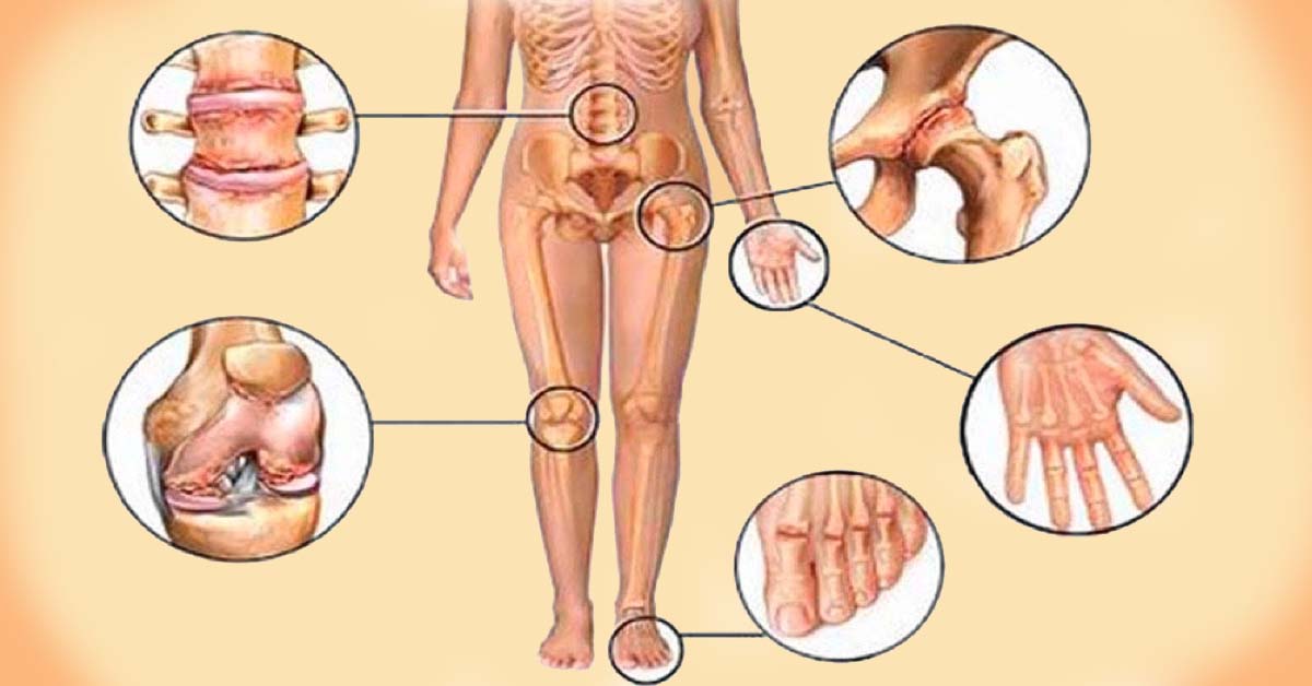 skausmo priežastis mažose sąnariuose artritas artrozė gydymas liaudies gynimo