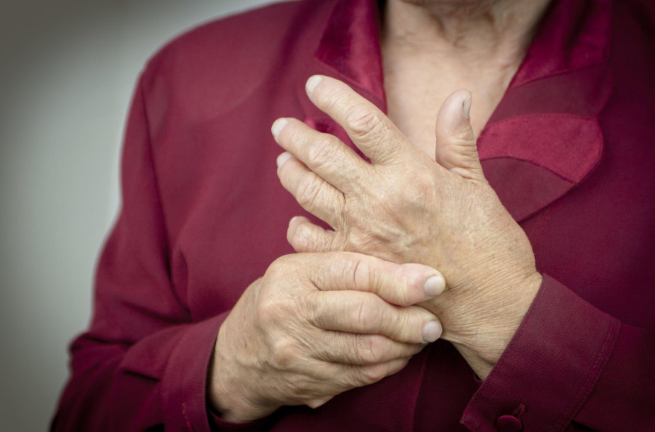 artritas sąnarių ranka gydymas