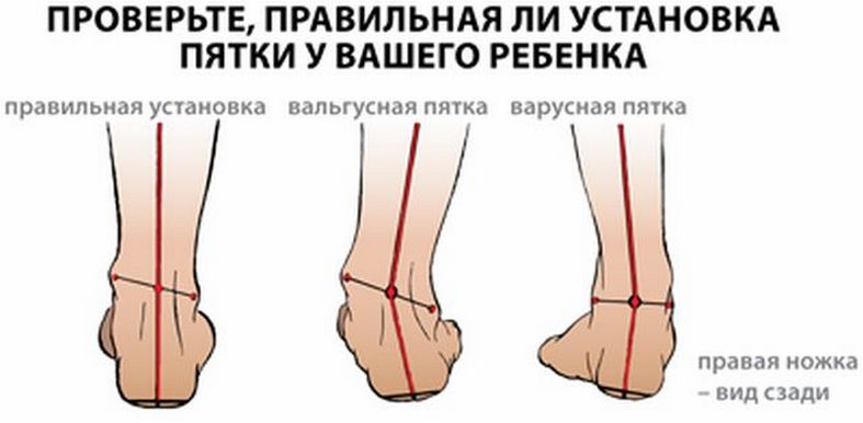 schema artrozės pėdų gydymui sąnarių skausmas tabletes
