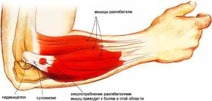 artrozė iš dešinės alkūnės sąnario keičiantis oras