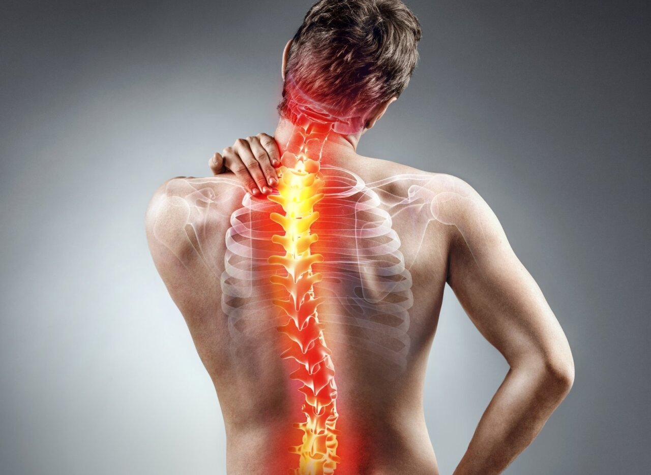 kaip elgtis su nugaros skausmu ir reumatoidinio sąnarių skausmas kaip nustatyti kas skauda sąnarį ar raumenis