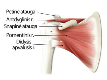 artrozė peties sustain 1 etapas gydymas peties skausmas pereinantis i ranka
