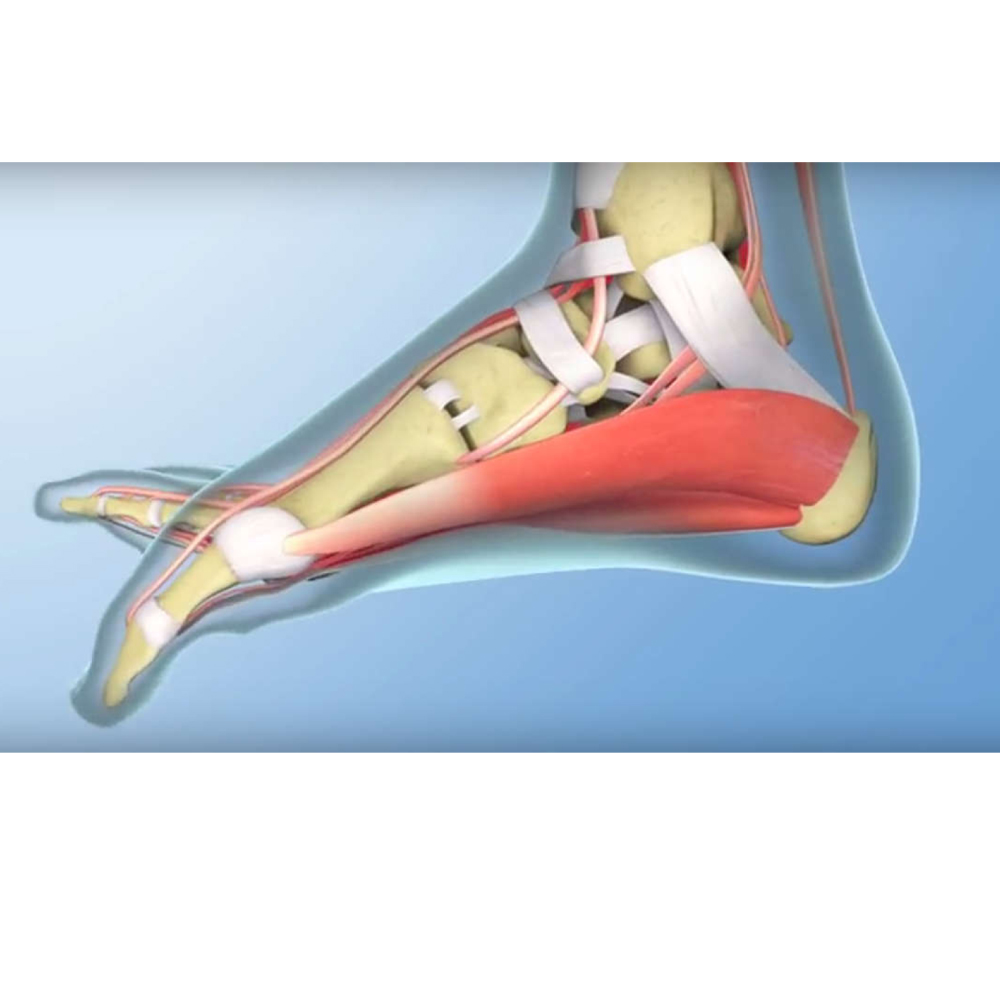 atsilenkimai ir gerklės sąnarių pėdos artrito ir artrozė pušų aliejus