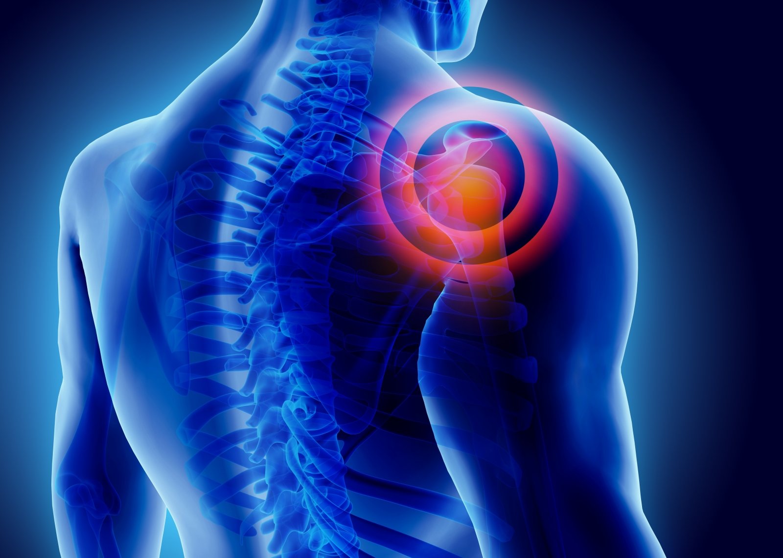skausmas desineje nugaros puseje ties juosmeniu artrozė peties išlaikyti padarinių
