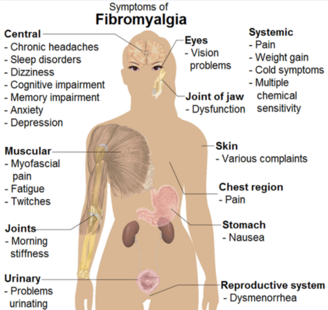 kaip prasideda fibromialgija