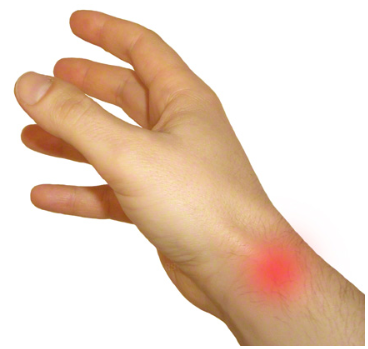 liaudies gydymas nuo iš rankų pirštų sąnarius rheumatoid arthritis symptoms