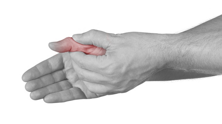 artritas iš pėdos sąnarių gydymas artrozės po insulto