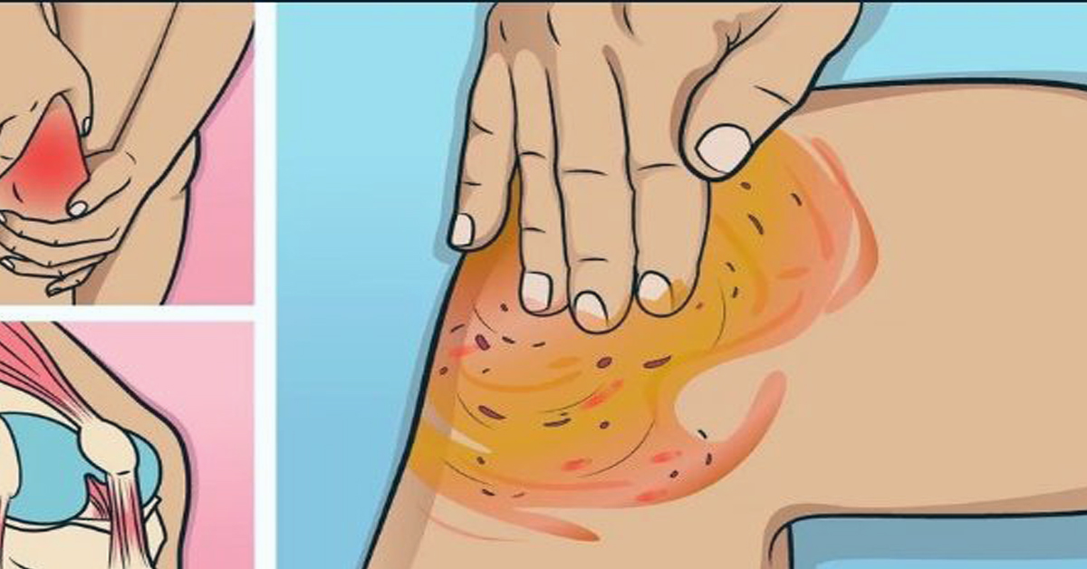 naminis priemonė sąnarių skausmas elbow sustaines gydymas