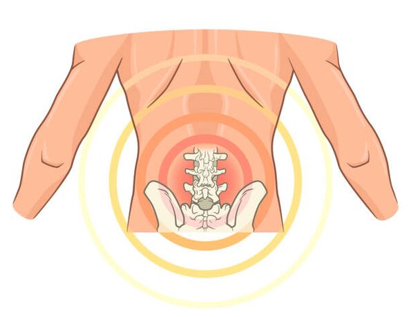 artrozė sustava skausmas raumenyse ir sąnariuose su sklerodermija
