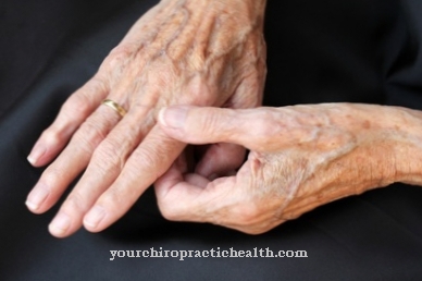 prevencija artritu ir artrozė pirštais