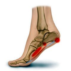 skausmas pėdos pėdos po traumos skausmas alkūnės sąnario dešinės rankos raumenų skausmo