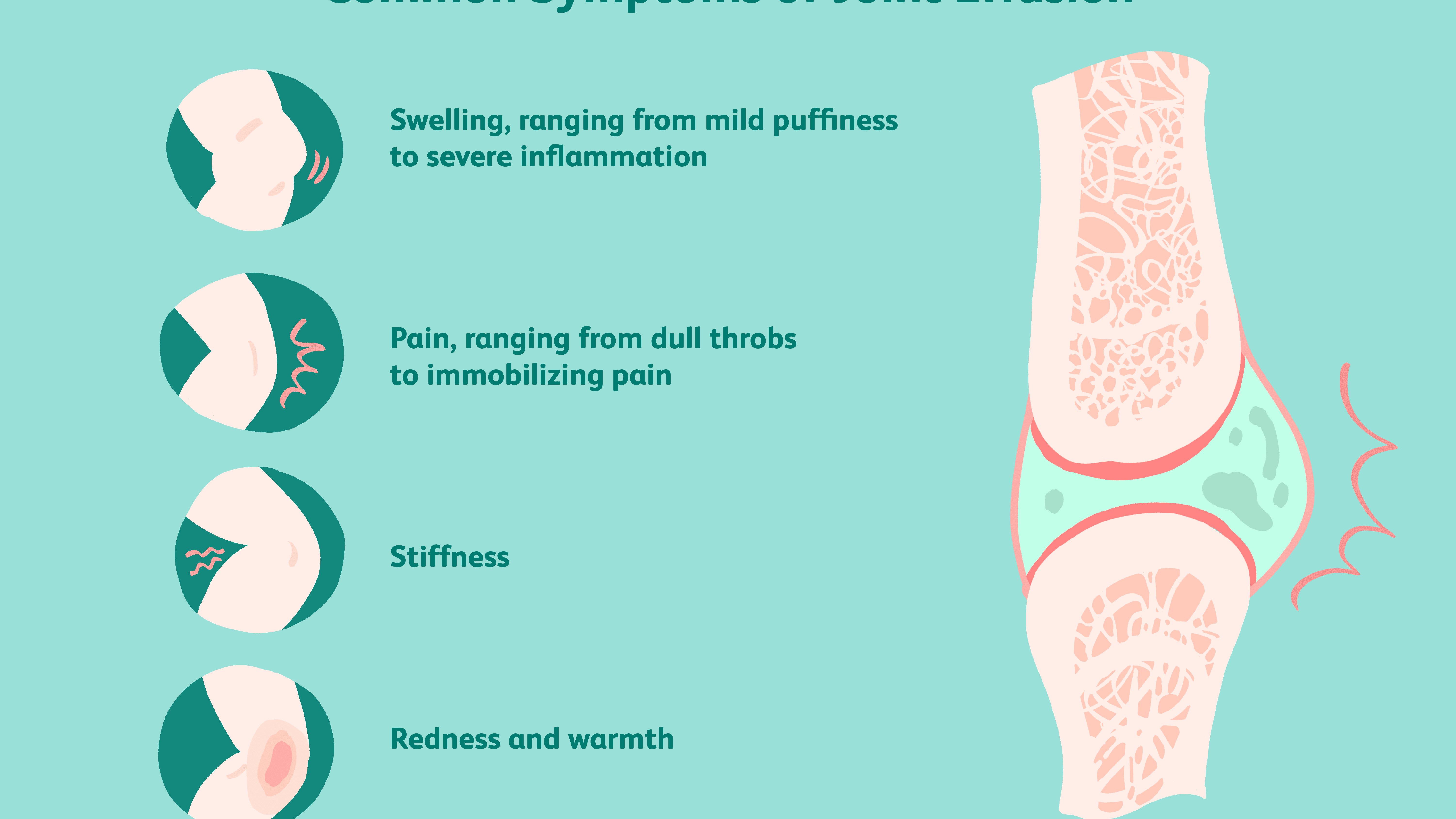 swelling between joints sąnarių pirštų valymo tepalas