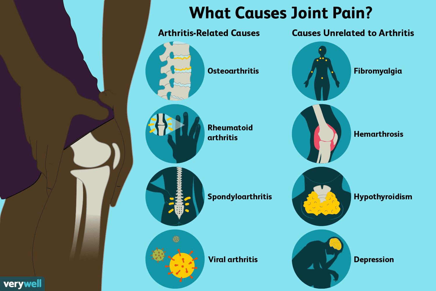 swelling in joints without pain skauda sąnarį ant šepečių rankose nei tepinėlis