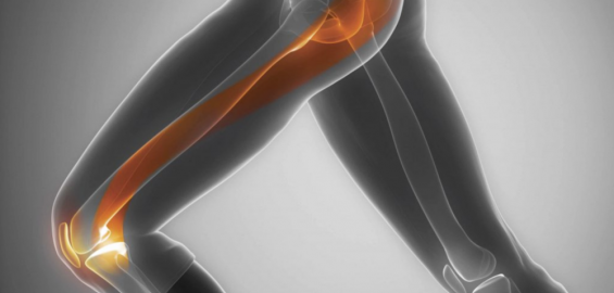 po vaikščioti skauda šlaunikaulio bendra yra ištrinant šį artritas