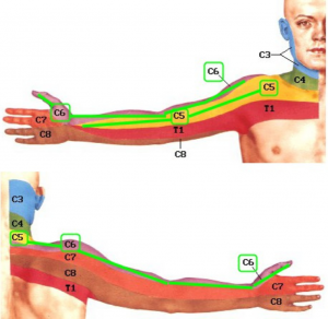 skauda ranku raumenis paviršiaus artritas pirštai