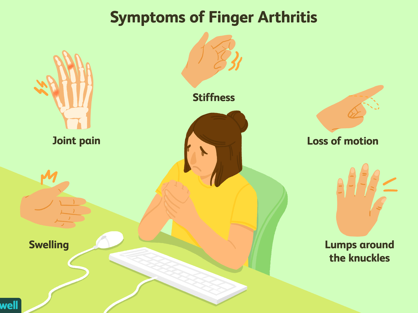 kas atsitinka su bendru artrozės