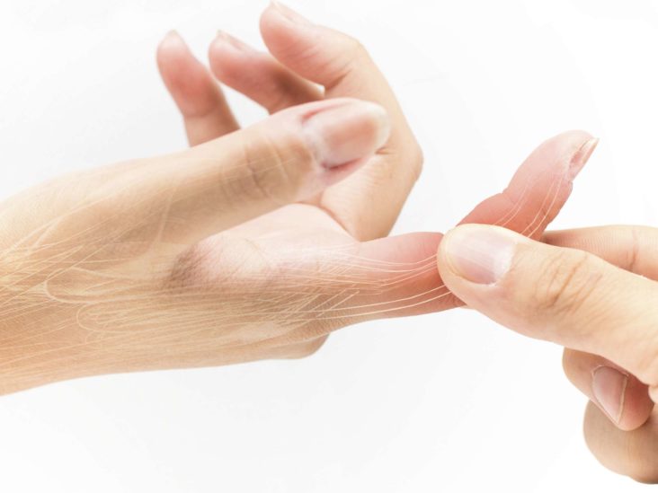 swollen painful finger joints pregnancy sumažinti uždegimą bendroje tepalas