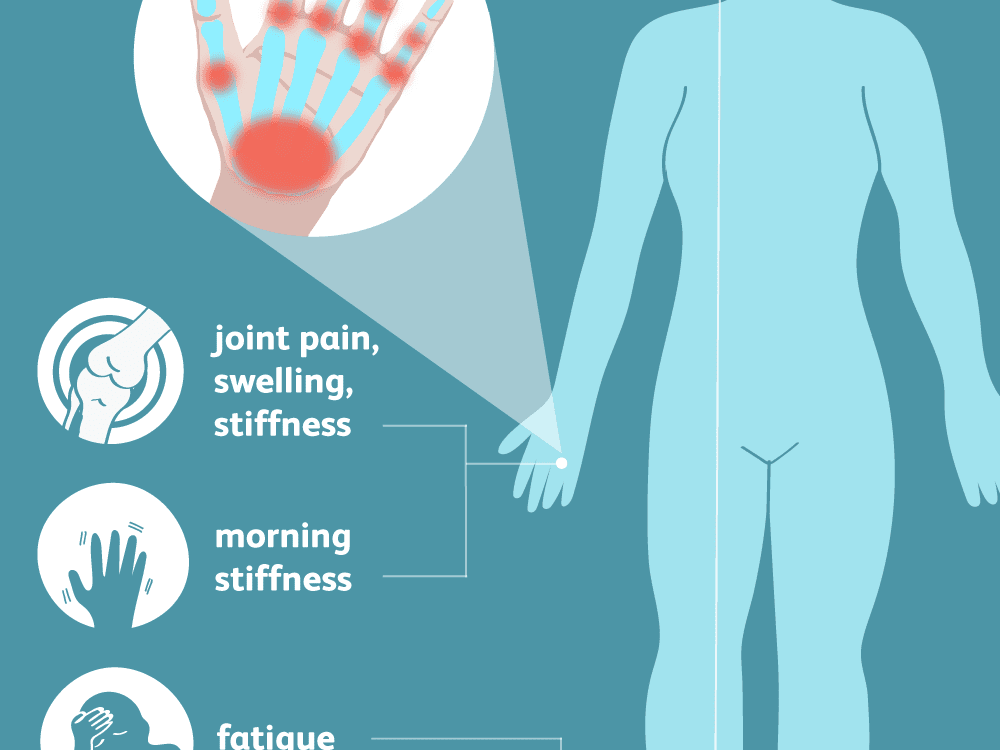 edema stiff joints
