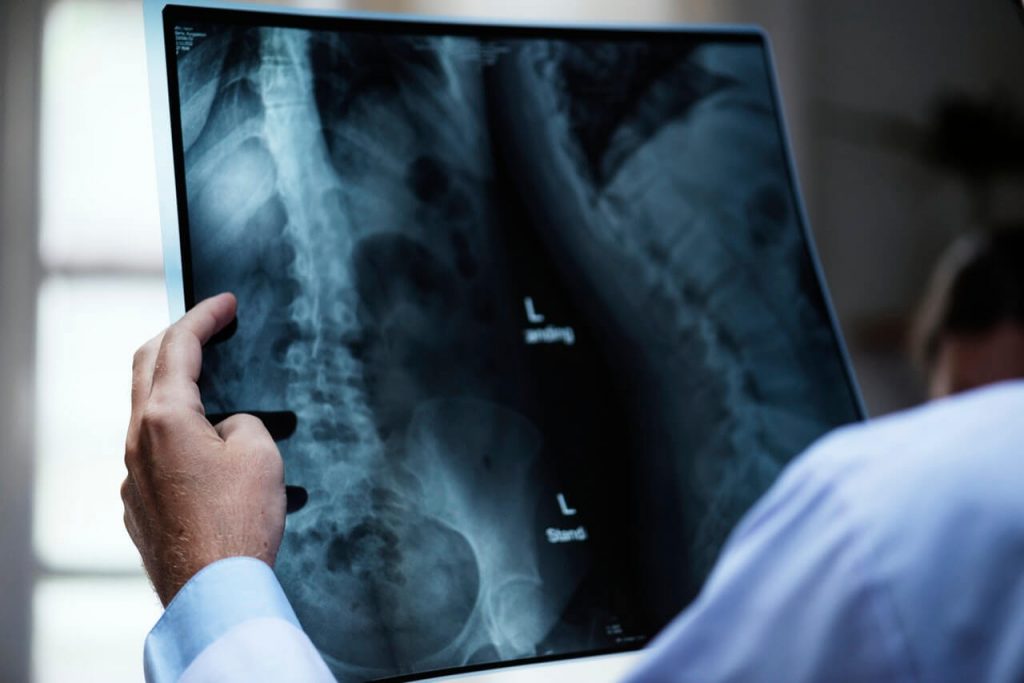 podagra wikipedia gydymas osteoartrito sąnarių stotelės