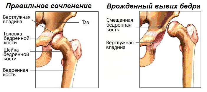 osteopathic gydymo metodas sąnarių sąnariai ir raumenys gydymas